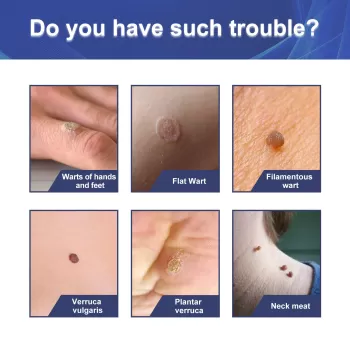Jaysuing Skin Tag Patech - 144 Patech Jaysuing Skin Tag Patech - 144 Patech