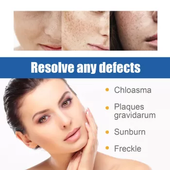 Jaysuing Light Spot Cream - Day and Night Jaysuing Light Spot Cream - Day and Night