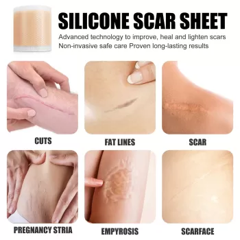 Jaysuing Silicone Scar Sheets Jaysuing Silicone Scar Sheets