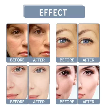 Jaysuing Retinol Face Serum Wrinkle Removal Jaysuing Retinol Face Serum Wrinkle Removal