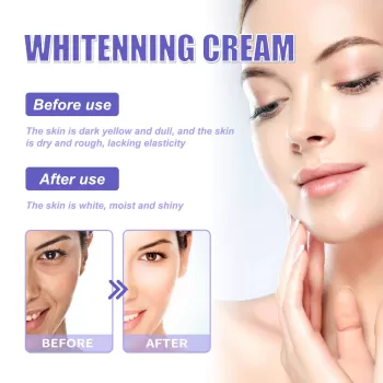 Jaysuing Whitening Cream Face Jaysuing Whitening Cream Face