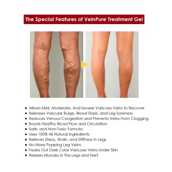 Jaysuing Varicose Vein Gel Spary Jaysuing Varicose Vein Gel Spary