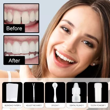 Jaysuing Temporary Tooth Repair Kit Jaysuing Temporary Tooth Repair Kit