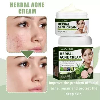 Jaysuing Herbal Acne Removing Cream Jaysuing Herbal Acne Removing Cream