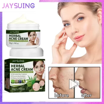 Jaysuing Herbal Acne Removing Cream Jaysuing Herbal Acne Removing Cream
