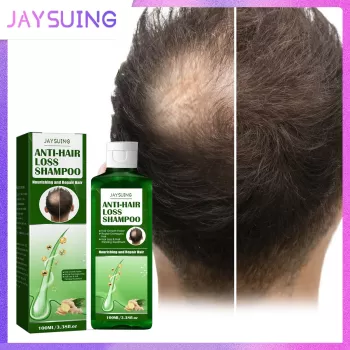 Jaysuing Ginger Shampoo Hair Growth Jaysuing Ginger Shampoo Hair Growth