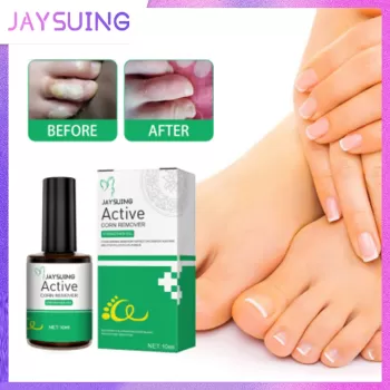 Jaysuing Wart Corns Remover Gel Jaysuing Wart Corns Remover Gel