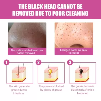 Jaysuing Aloe Vera Blackhead Removing Glue Jaysuing Aloe Vera Blackhead Removing Glue