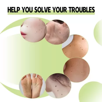 Jaysuing Mole Removal Serum Non-marking Jaysuing Mole Removal Serum Non-marking