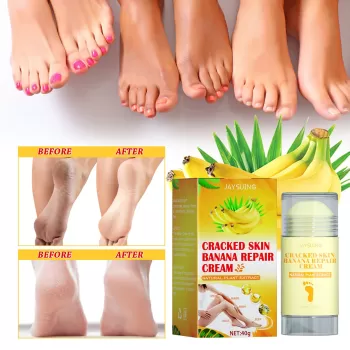 Jaysuing Foot Crack Cream Banana Moisturizing Jaysuing Foot Crack Cream Banana Moisturizing