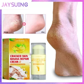 Jaysuing Foot Crack Cream Banana Moisturizing Jaysuing Foot Crack Cream Banana Moisturizing