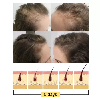 Jaysuing Anti-Hair Loss Ginger Shampoo Bar Jaysuing Anti-Hair Loss Ginger Shampoo Bar