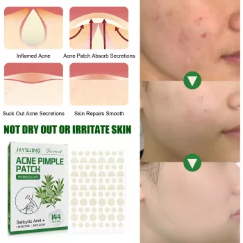 Jaysuing Acne Pimple Patch Jaysuing Acne Pimple Patch