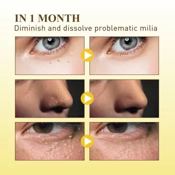 Jaysuing Fat Granules Removal Eye Cream Jaysuing Fat Granules Removal Eye Cream