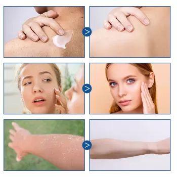 Jaysuing Body Moisturizing Cream Improve Skin Jaysuing Body Moisturizing Cream Improve Skin