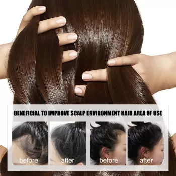 Jaysuing Hair Growth Essence Growing Anti Hair Loss Jaysuing Hair Growth Essence Growing Anti Hair Loss
