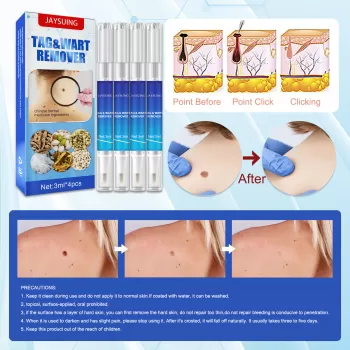 Jaysuing Wart Remover Skin Tag Removal Pen Jaysuing Wart Remover Skin Tag Removal Pen