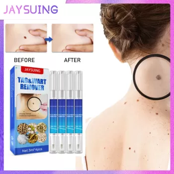 Jaysuing Wart Remover Skin Tag Removal Pen Jaysuing Wart Remover Skin Tag Removal Pen