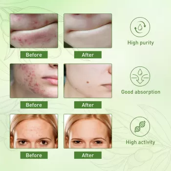 Jaysuing Olives Oil Face Care Essential Oil Jaysuing Olives Oil Face Care Essential Oil