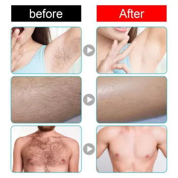 Jaysuing Hair Removal Cream Jaysuing Hair Removal Cream