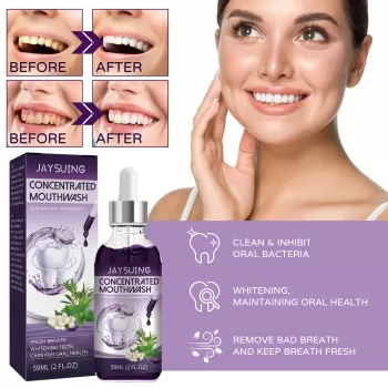 Jaysuing Concentrated Mouthwash Whitening Teeth Jaysuing Concentrated Mouthwash Whitening Teeth