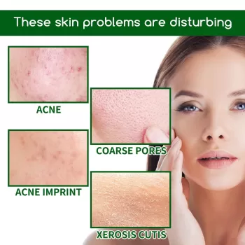 Jaysuing Acne Treatment Face Serum Jaysuing Acne Treatment Face Serum
