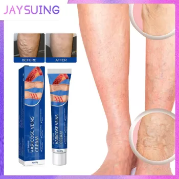 Jaysuing Varicose Vein Cream Jaysuing Varicose Vein Cream