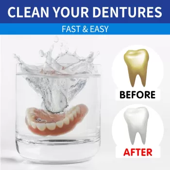 Jaysuing Denture Cleansing Tablet Remove Jaysuing Denture Cleansing Tablet Remove