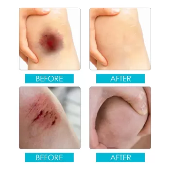 Jaysuing Waterproof Hemostatic Breathable Spray Jaysuing Waterproof Hemostatic Breathable Spray