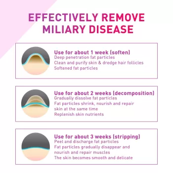 Jaysuing Milia Remover Eye Serum Jaysuing Milia Remover Eye Serum