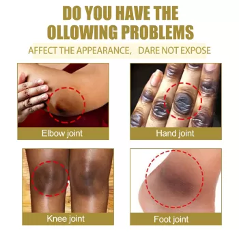 Jaysuing Dark Knuckles Whitening Serum Jaysuing Dark Knuckles Whitening Serum