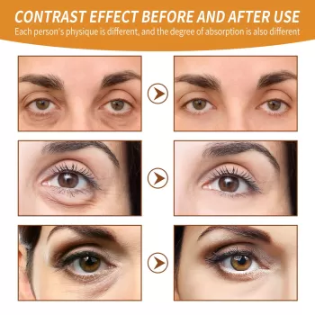 Jaysuing Under Eye Serum Roller 3 IN 1 Jaysuing Under Eye Serum Roller 3 IN 1