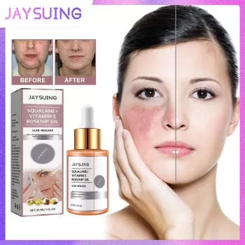 Jaysuing Scar Removal Rosehip Oil Jaysuing Scar Removal Rosehip Oil
