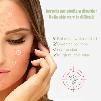 Jaysuing Facial Soothing Moisturizing Serum Jaysuing Facial Soothing Moisturizing Serum
