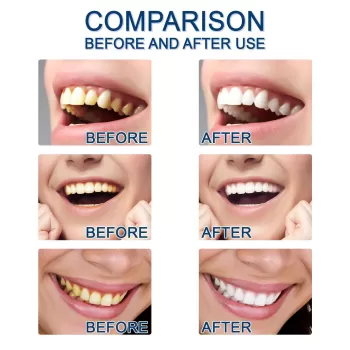 Jaysuing Teeth Whitening Essence Jaysuing Teeth Whitening Essence