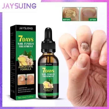 Jaysuing Nail Fungus Treatment Essence Serum Jaysuing Nail Fungus Treatment Essence Serum
