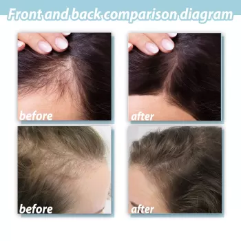 Jaysuing Hair Scalp Scrub Anti-dandruff Jaysuing Hair Scalp Scrub Anti-dandruff