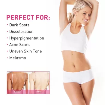 Jaysuing Skin Lightening Cream for Dark Skin Jaysuing Skin Lightening Cream for Dark Skin