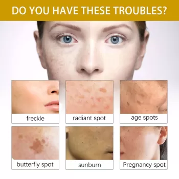 Jaysuing Whitening Essential Oil for Face Jaysuing Whitening Essential Oil for Face