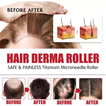 Jaysuing Hair Derma Roller Microneedle Roller Jaysuing Hair Derma Roller Microneedle Roller