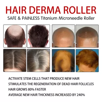 Jaysuing Hair Derma Roller Microneedle Roller Jaysuing Hair Derma Roller Microneedle Roller